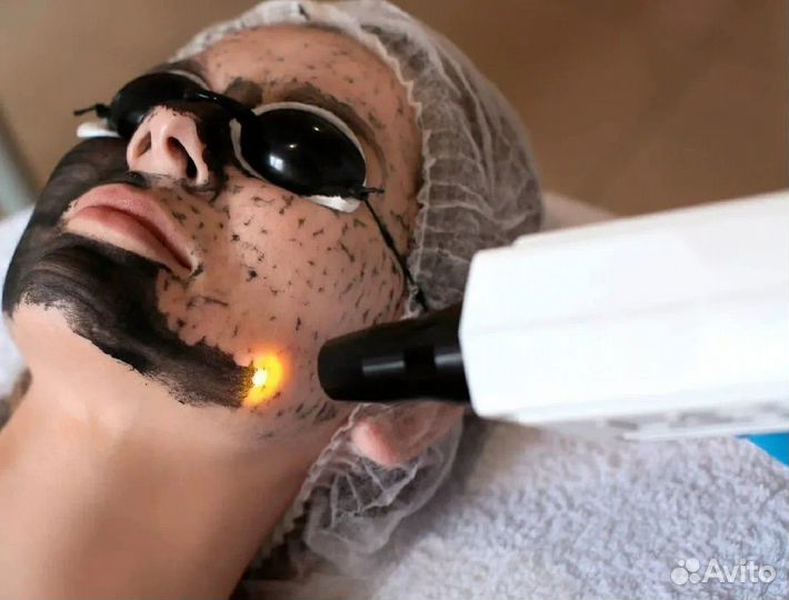 Чистка лица, карбоновый пилинг