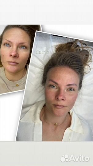 Брови в волосковой технике