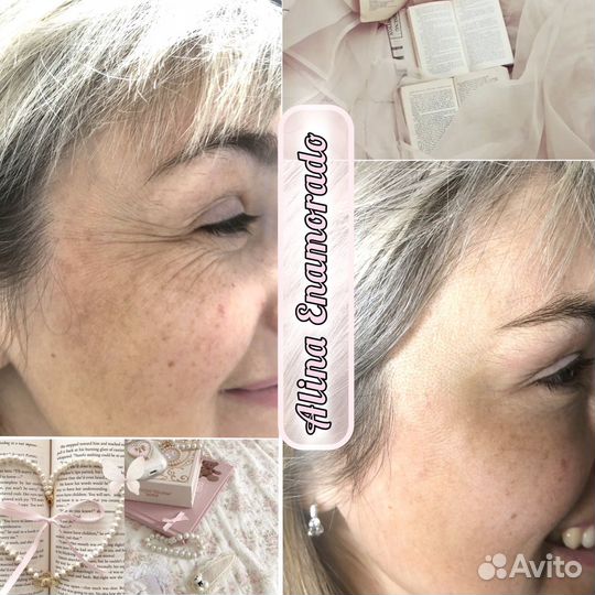 Нужны модели на ботокс