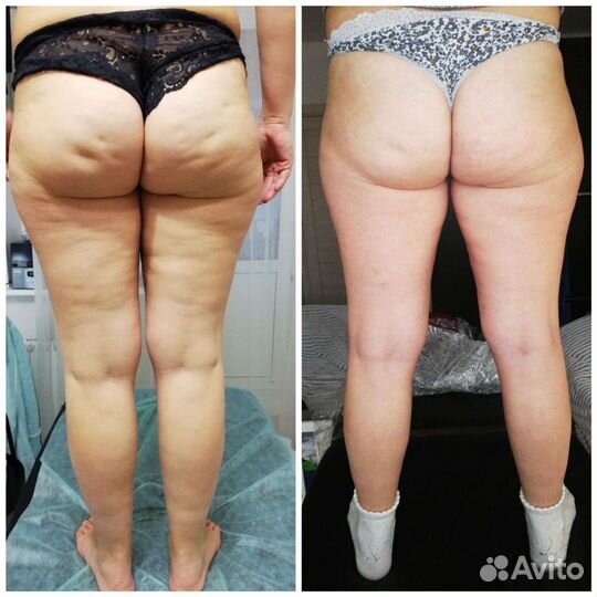 Массаж, шугаринг/ваксинг Гольяново