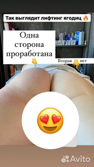 Антицеллюлитный массаж аппаратный, ручной