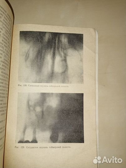 Рентгенодиагностика заболеваний лицевого черепа. 1