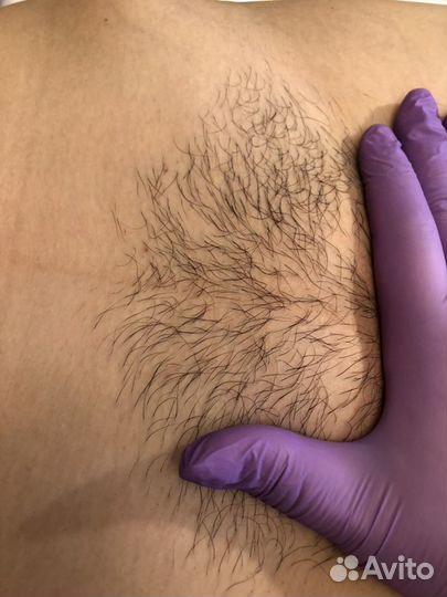 Spa-шугаринг