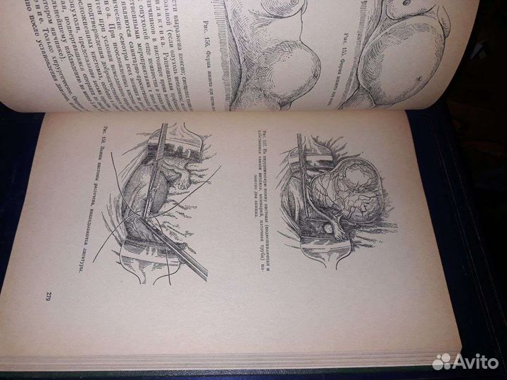 Гинекология Бодяжина Вера Ильинична, Жмакин