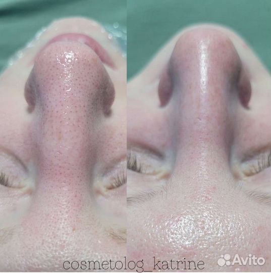 Услуги косметолога