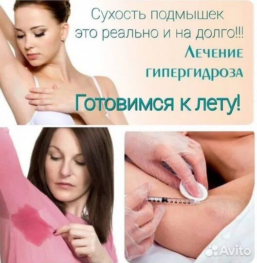 Лечение гипергидроза