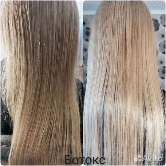 Ботокс/Нанопластика/Флисинг