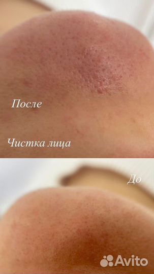 Косметолог эстетист