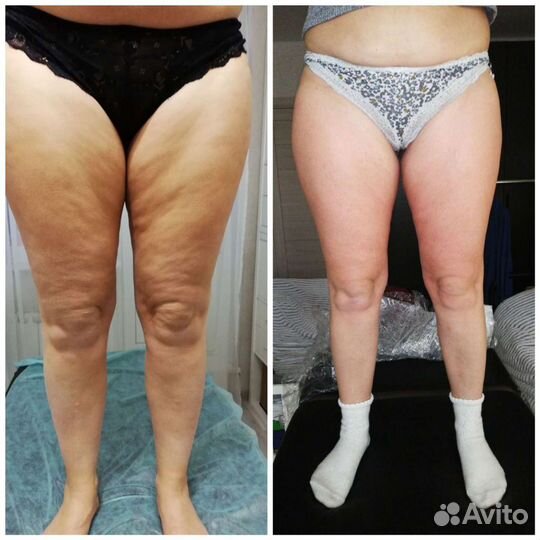 Массаж, шугаринг/ваксинг Гольяново