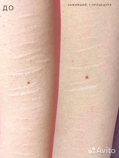 Перманентный макияж, татуаж