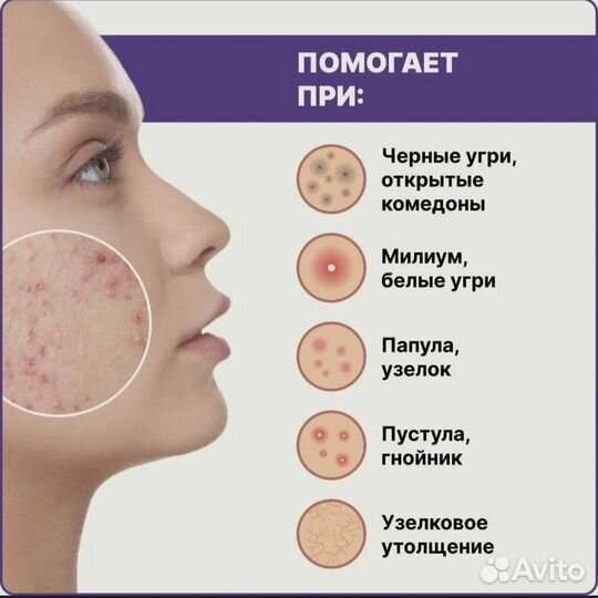 Масло для лица против акне Sky Crystal Beauty 30мл