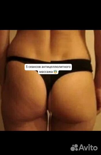Антицеллюлитный массаж