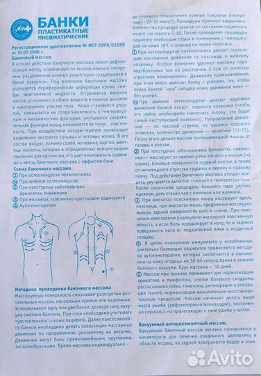 Вакуумные банки