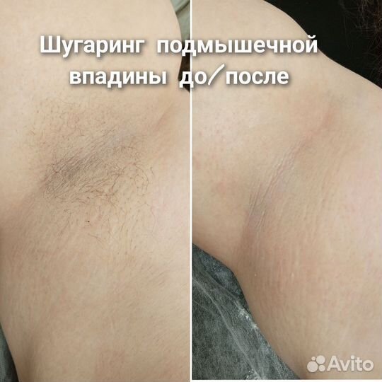 Модель на шугаринг