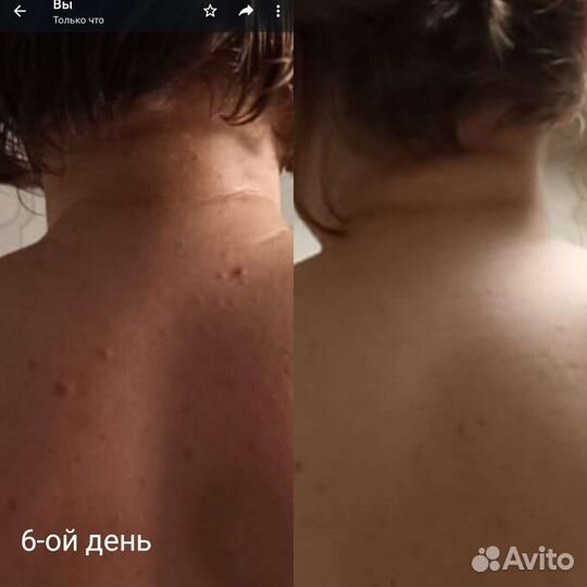 Массаж лица и тела(медицинское образование)