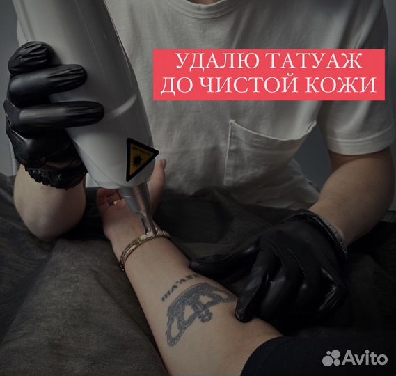 Лазерное удаление тату и татуажа