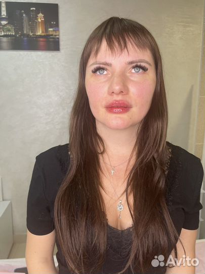 Увеличение губ