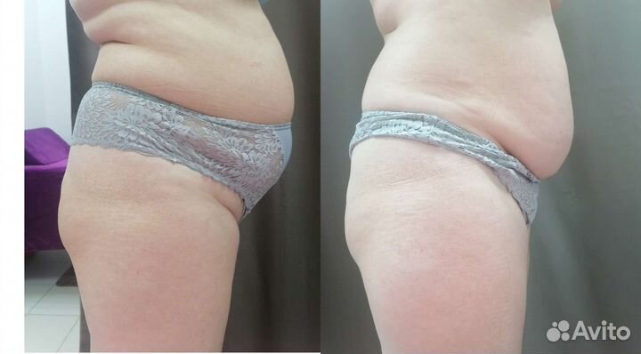 Все виды массажа для женщин