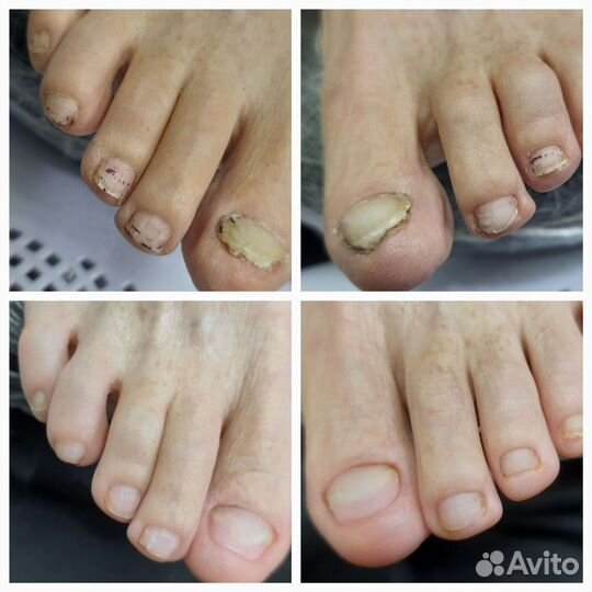 Подолог, педикюр, маникюр