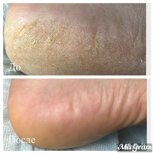 Педикюр Маникюр на дому выезд