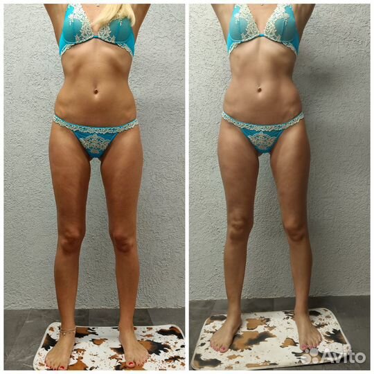 Аппаратный массаж/Вибромассаж