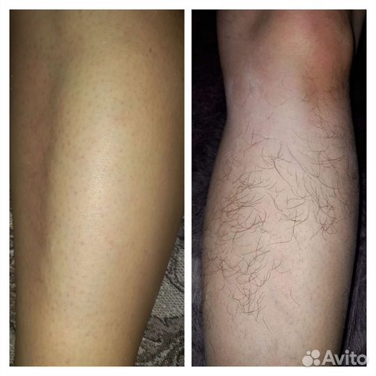 Модели на шугаринг