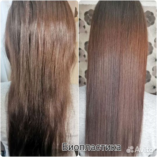 Ботокс/Нанопластика/Флисинг