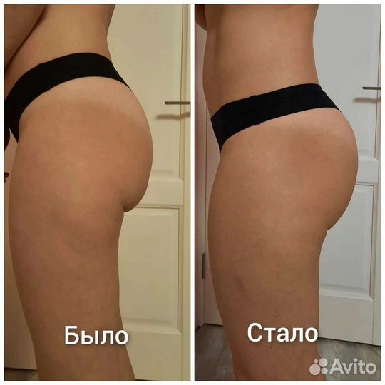 Липосоникс