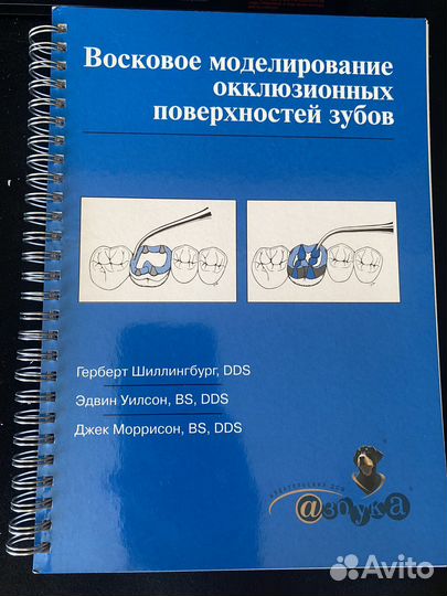 Восковое моделирование