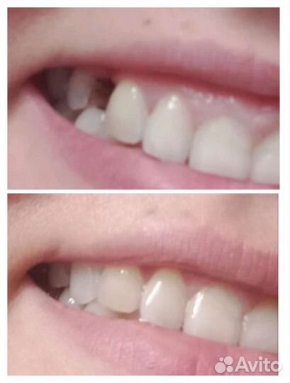 Временная пломба на длительный срок 2022 CityShop