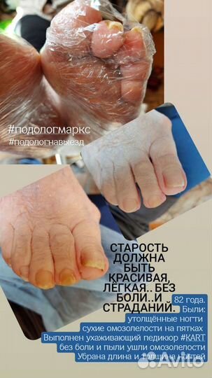 Подологический педикюр Маркс, район