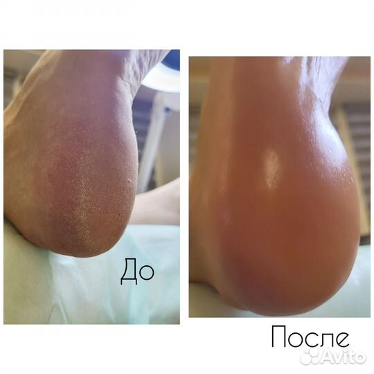 Смарт педикюр, маникюр