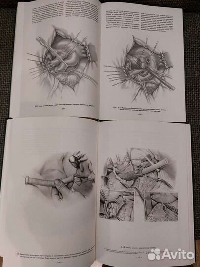 Атлас грудной хирургии. 2 тома. Петровский Б.В