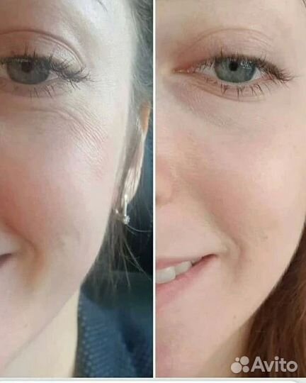 Эко косметолог/ массаж лица и тела