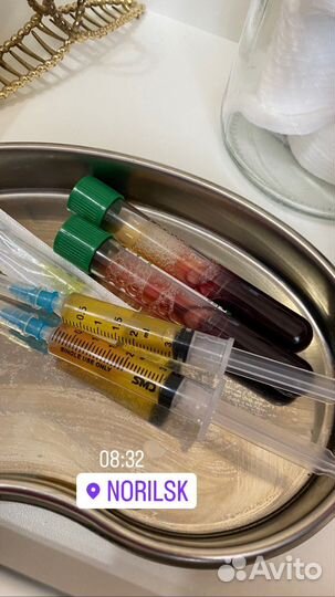 Плазмолифтинг