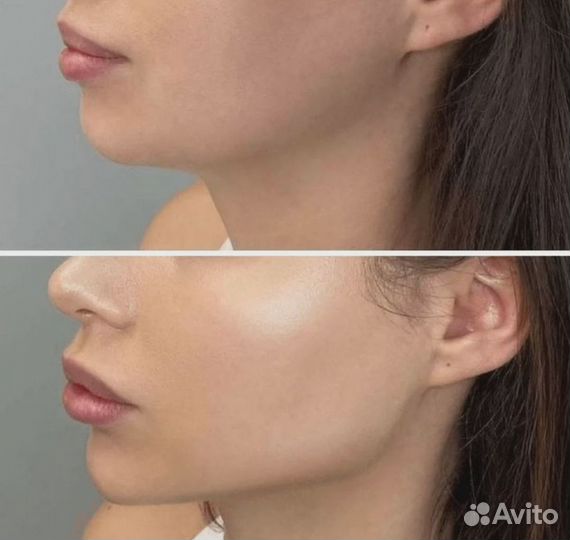 Услуги косметолога