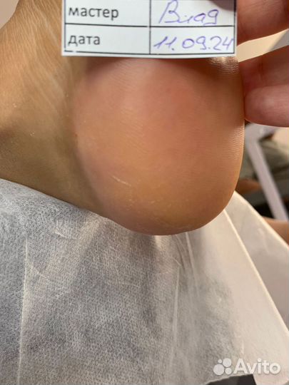 Подологический педикюр