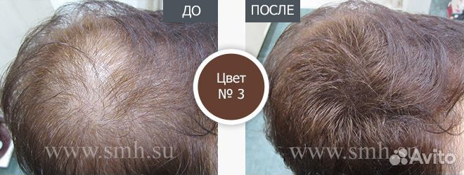 Загуститель для волос из Японии + спрей в подарок