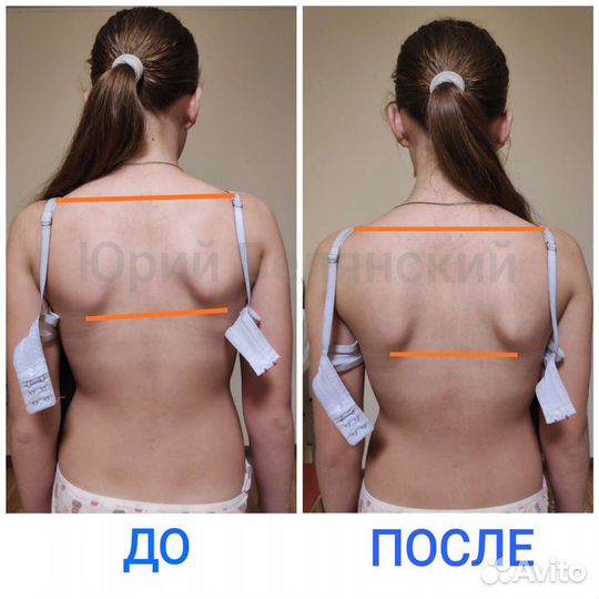 Лечебный Массаж. Безопасная коррекция позвоночника