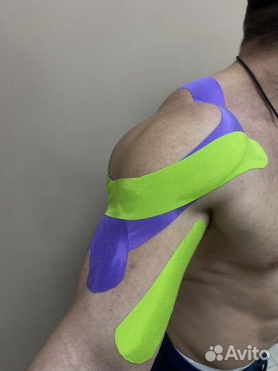 Тейпирование