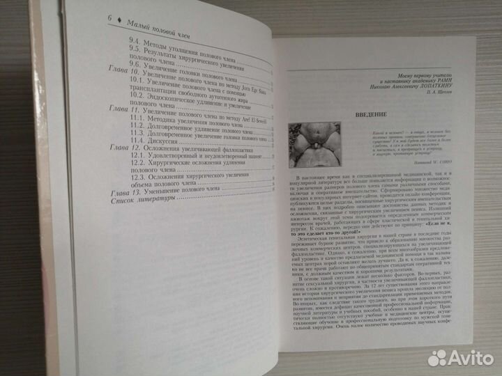 Малый половой член. Методы коррекции / П. Щеплев