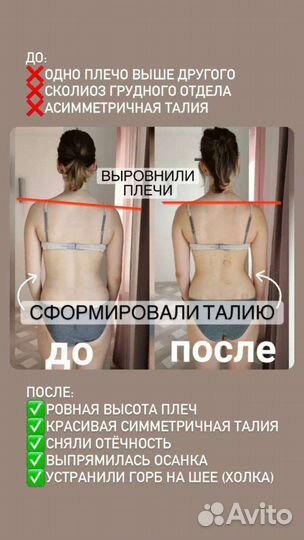 Лечебный массаж в г. Пушкин