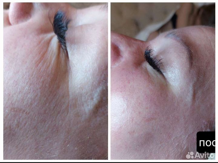 Косметик-Эстетист. Депиляция