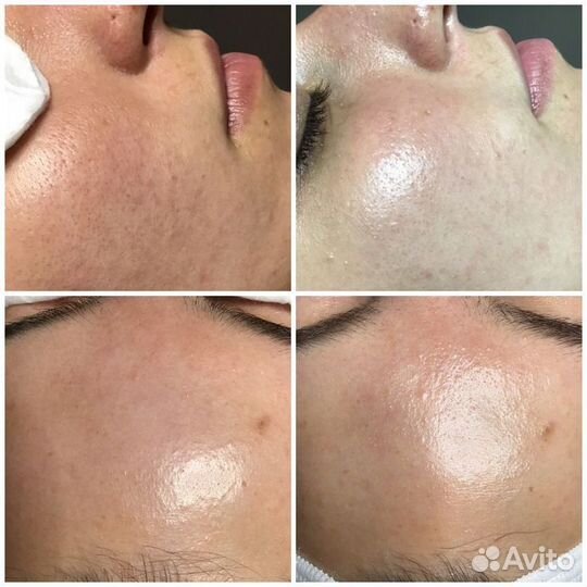 Косметолог - Эстет