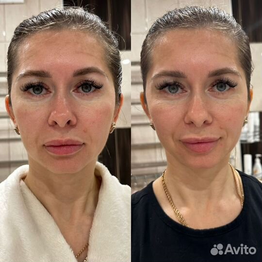 Средство от отёков