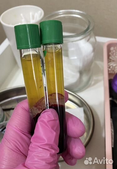 Плазмолифтинг