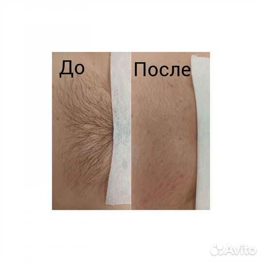 Депиляция воском