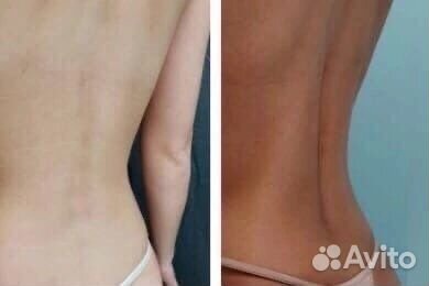 Моментальный загар