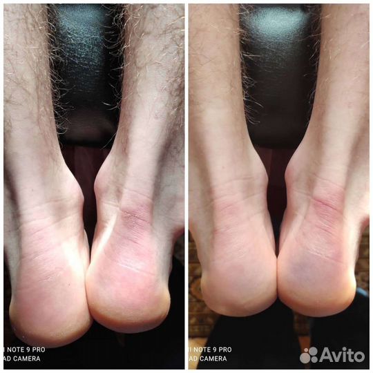 Мануальный терапевт