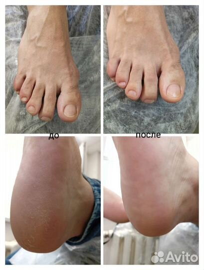 Педикюр женский и мужской